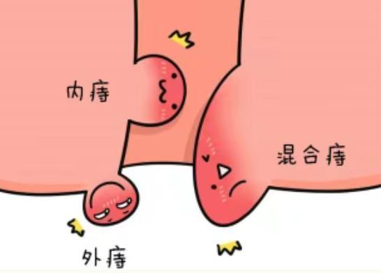 痔疮凝胶定制厂家